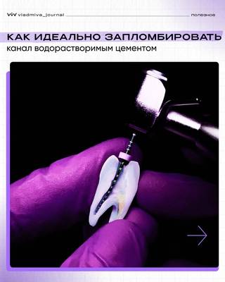 Биодентин. Водорастворимый цемент для сложных задач.